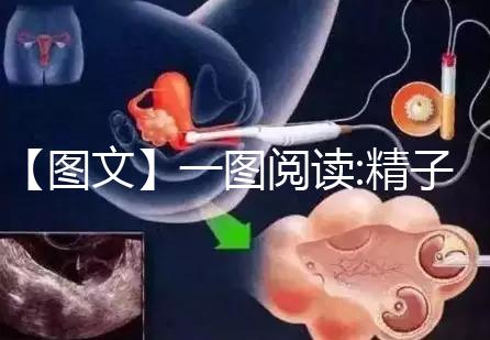 【圖文】一圖閱讀:精子和卵子結(jié)合有多難！