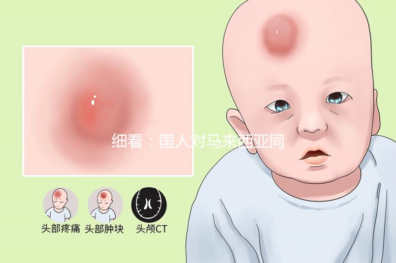 細(xì)看：國(guó)人對(duì)馬來(lái)西亞同善醫(yī)院試管嬰兒技術(shù)的評(píng)價(jià)