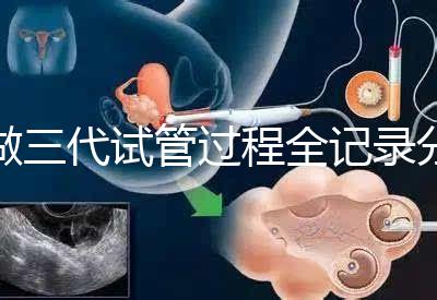 做三代試管過程全記錄分享（北醫三院）