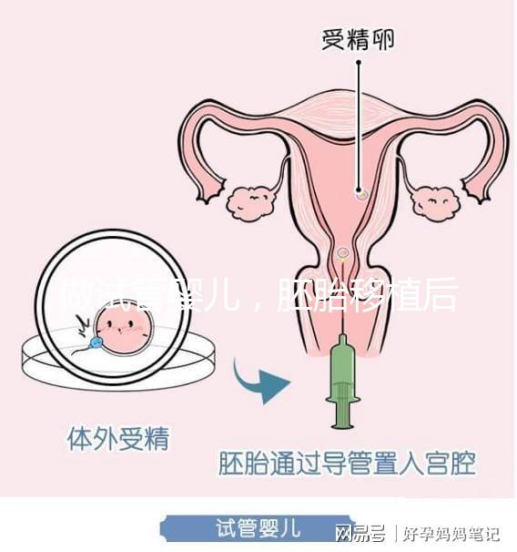 做試管嬰兒，胚胎移植后需要住院嗎？