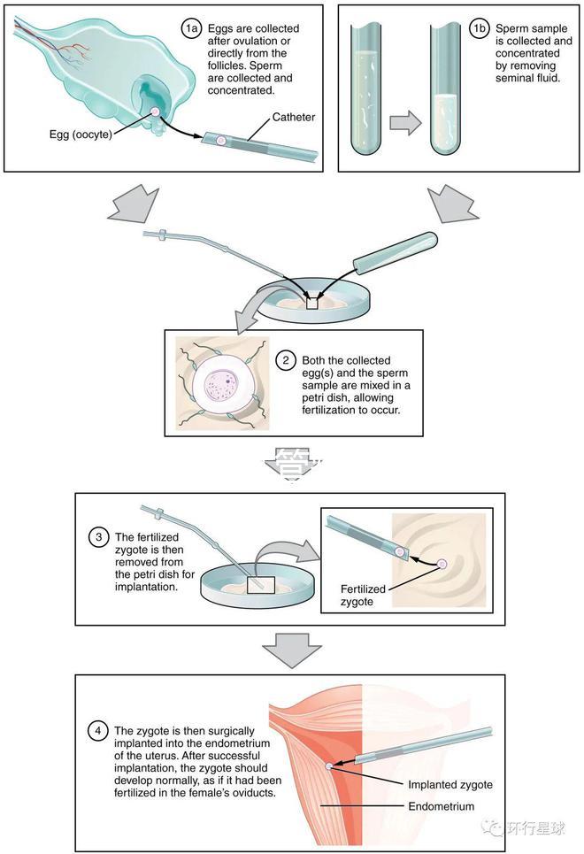 國(guó)內(nèi)首起試管嬰兒案例，法律竟難以給患者維權(quán)