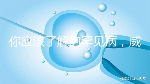 你應該了解的罕見病，威廉姆斯綜合癥