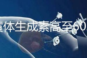 促黃體生成素高至60.48怎么辦?這3種方法可有效調(diào)理