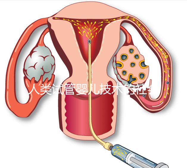 人類試管嬰兒技術的社會價值
