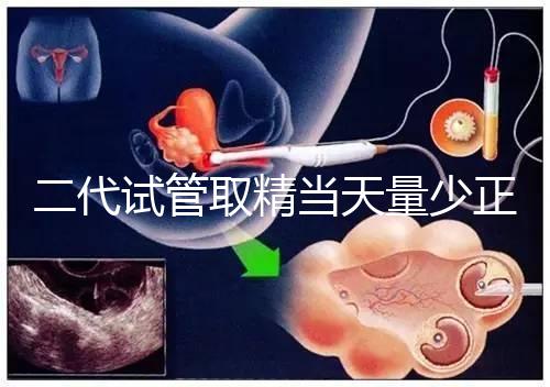 二代試管取精當天量少正不正常60s弄清，不造怎么辦速覽