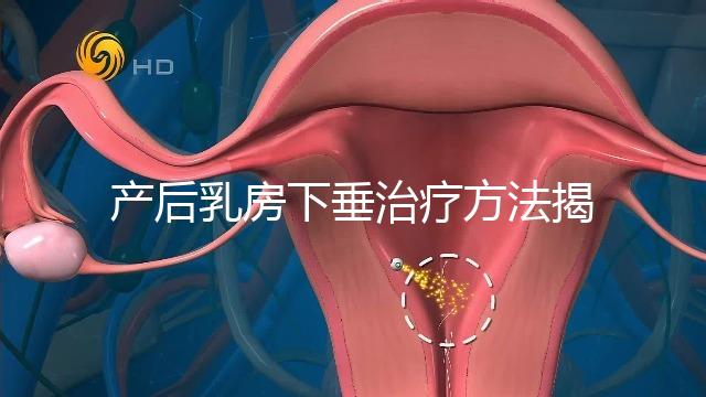 產后乳房下垂治療方法揭秘，按摩手法再好也沒提前預防有用