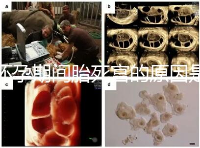 懷孕期間胎死宮的原因是什么？