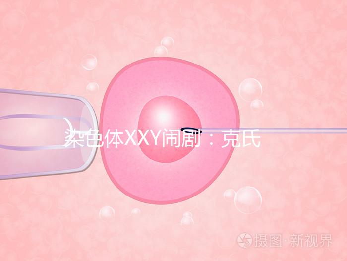 染色體XXY鬧?。嚎耸暇C合征，帶你走進(jìn)“第三性別”群體