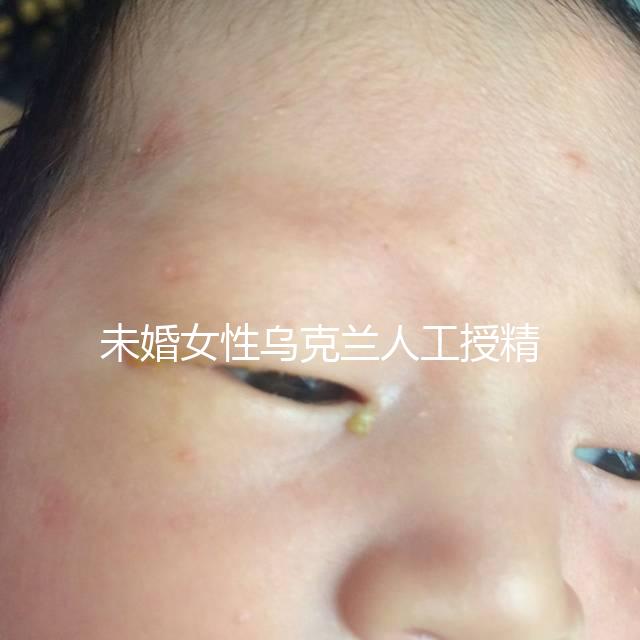 未婚女性烏克蘭人工授精必看！醫療及生活費用明細預覽