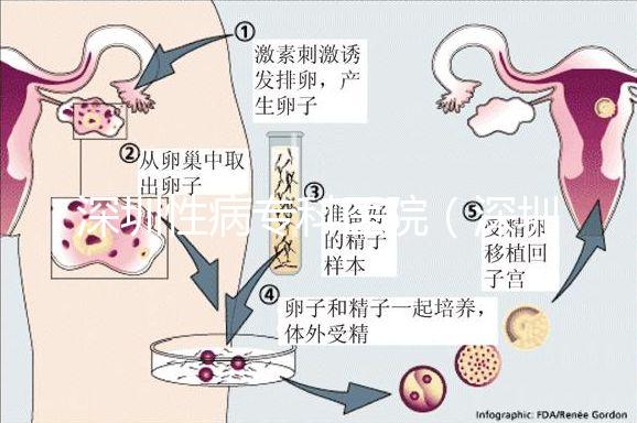 深圳性病專科醫院（深圳hpv病毒治療中心）