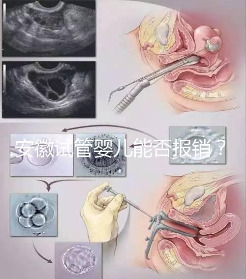 安徽試管嬰兒能否報銷？政策解讀幫您省錢！