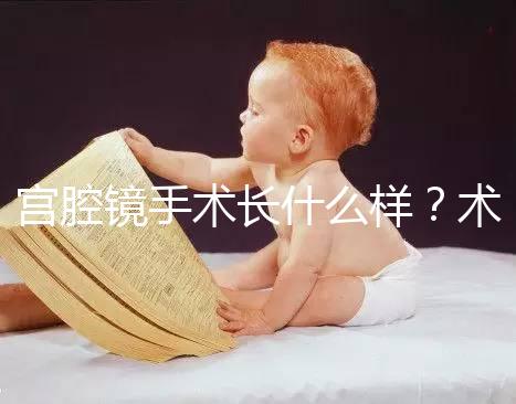 宮腔鏡手術長什么樣？術后要注意什么？ ?