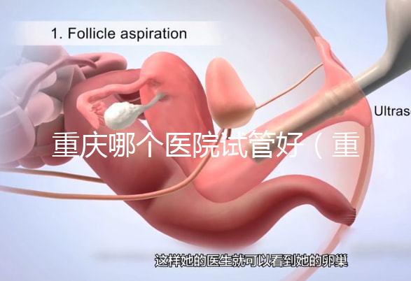 重慶哪個醫院試管好（重慶哪個醫院試管好一點）