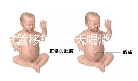 試管移植前幾天喝酒了有影響嗎？想要懷孕得管住嘴！