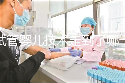 試管嬰兒技術(shù)走到了哪一步？專家解答→