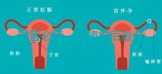 試管必讀,移植前后最全注意事項?