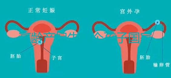 高齡產婦生八個孩子國家有補助？有沒有違法才是關鍵