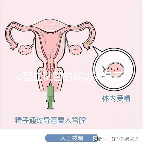 o型血試管的成功率是否高取決于這一點(diǎn)分享真正好的懷孕案例